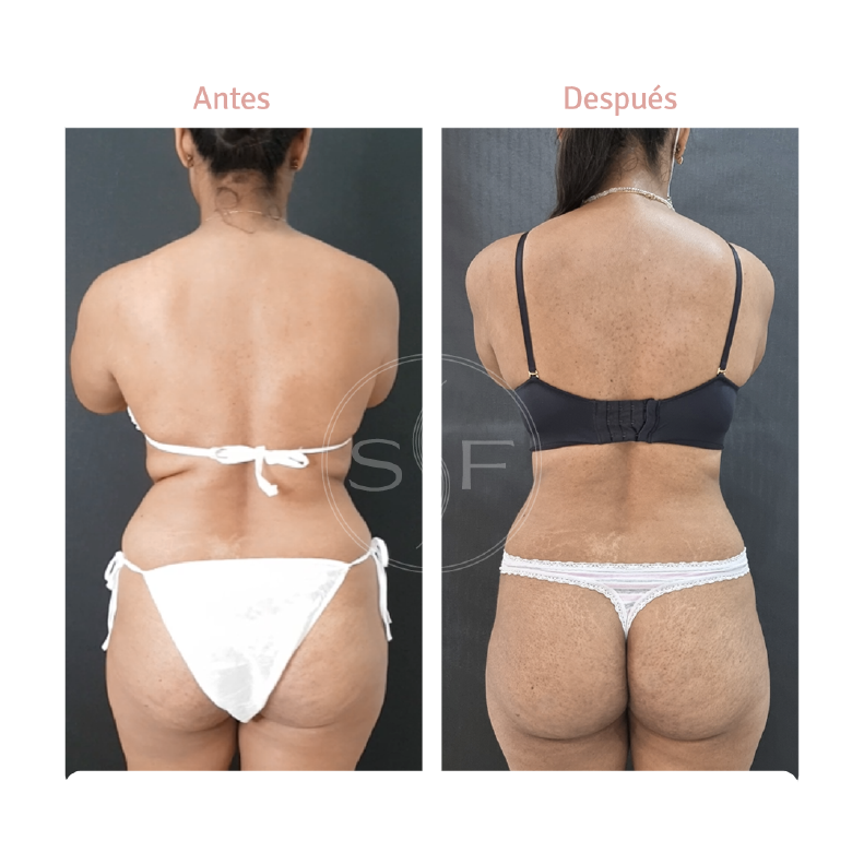 Asset 9