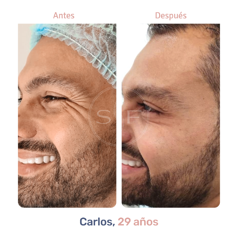 DES03
