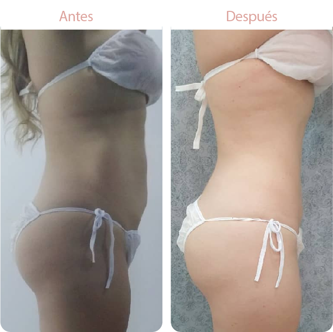 Recurso 1