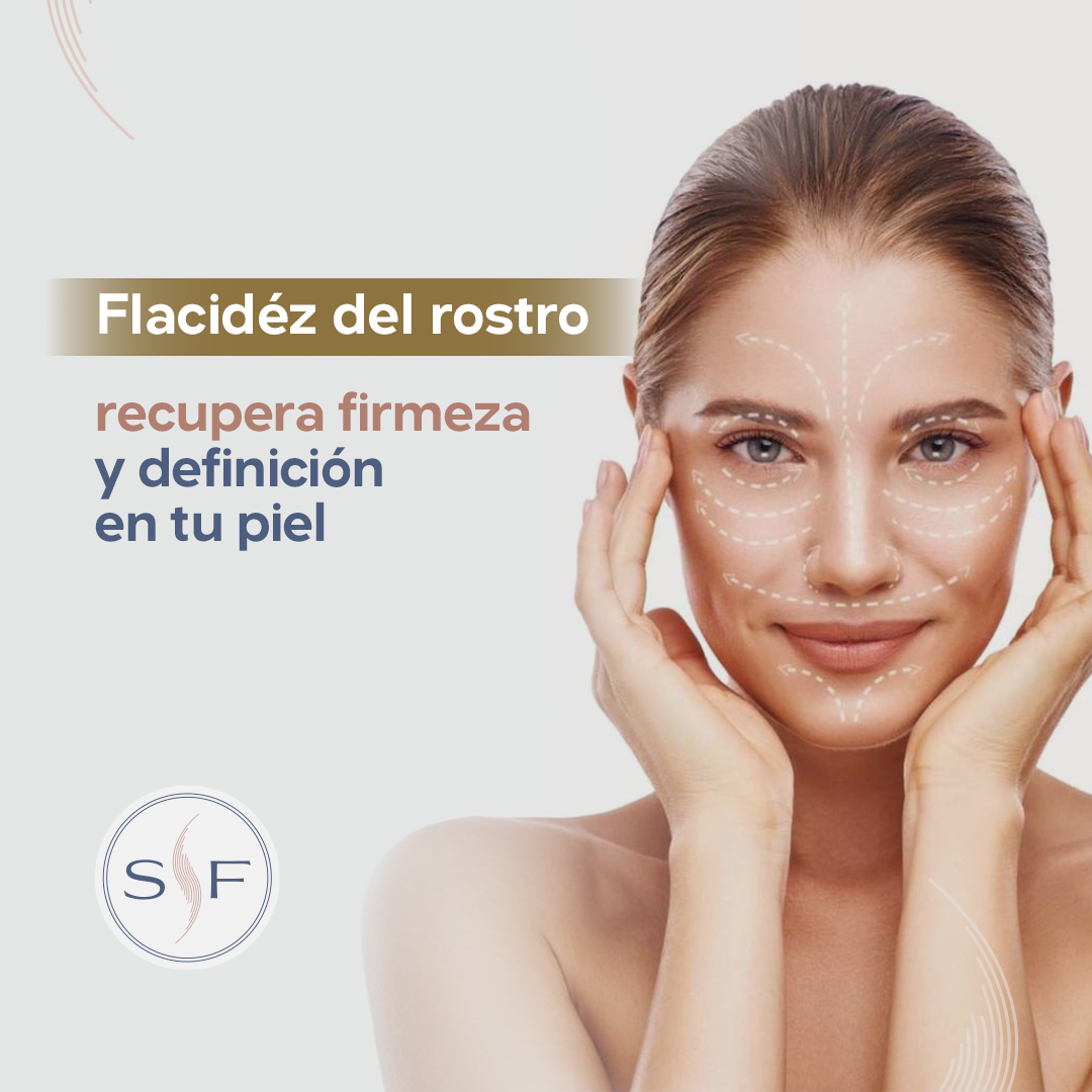 flacidez del rostro