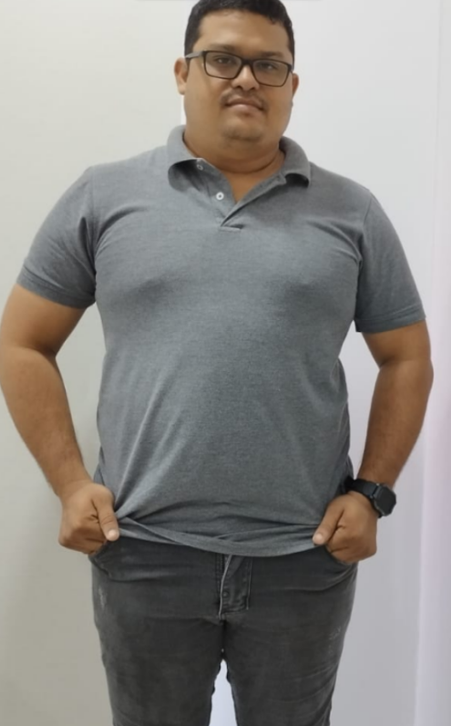 Antes del tratamiento - caso 3