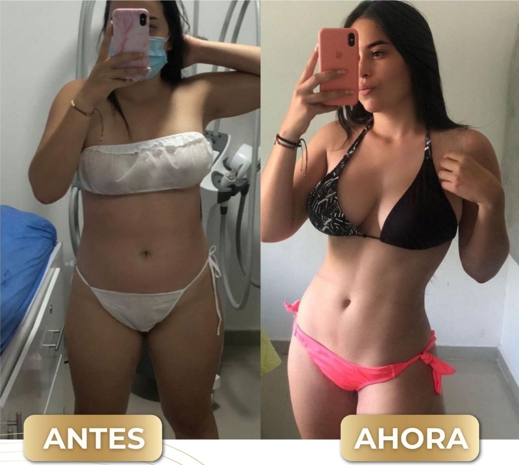 Resultado LNQ 2