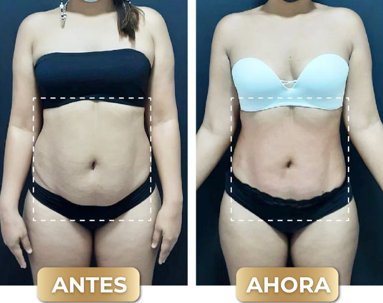 Resultado LNQ 4