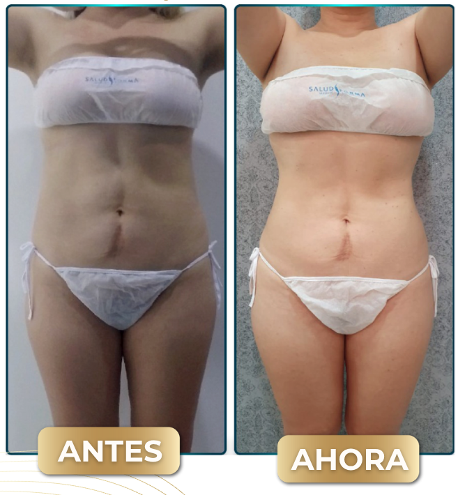 Resultado LNQ 6